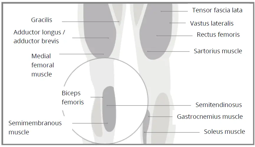 Yunmai-Fascia-Massage-Gun-Extra-Mini-fig-11