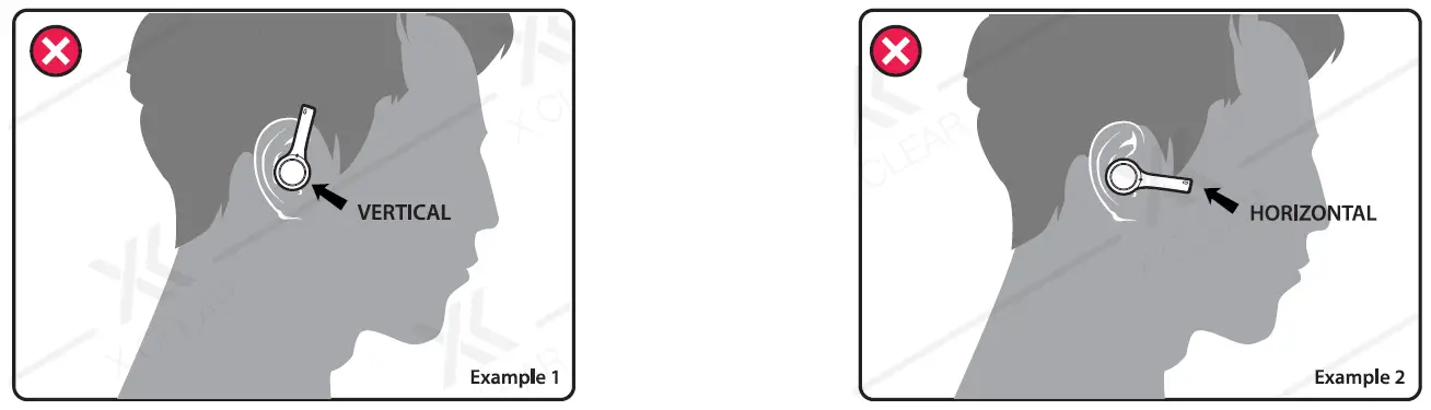 EXAMPLES OF IMPROPER FIT