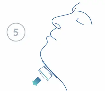 Nyxoah genioR Restful Nights - fig 5