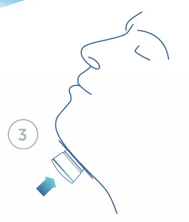 Nyxoah genioR Restful Nights - fig 7