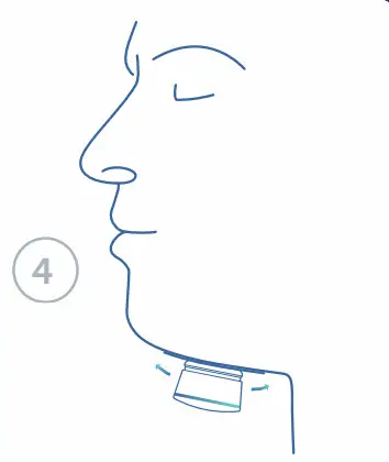 Nyxoah genioR Restful Nights - fig 8