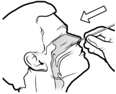 Artron COVID-19 Antigen Test 01