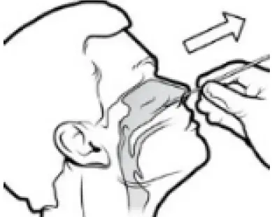 Artron COVID-19 Antigen Test 05