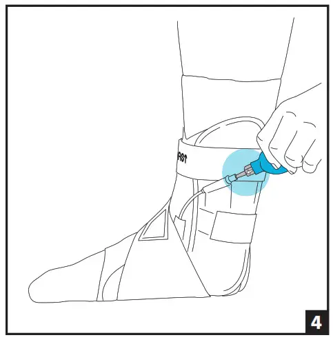 DJO Aircast AirLift PTTD Brace - 4