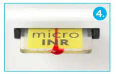 iLine -microsystems -GPC0001AD- MicroINR- Semi-Automatic- Coagulation- Analyzer- fig 6