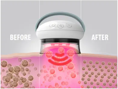 HoMEDiCS CELL-600-EU Smoothee IR Deep Tissue Massaging B3