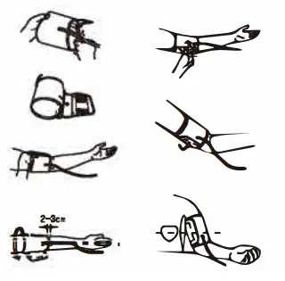 URION U85E Upper Arm Electronic Blood Pressure Monitor - Figure 1