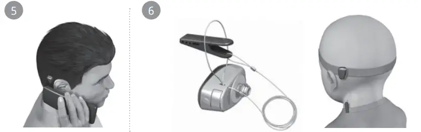 Cochlear-Baha-5-Sound-Processor-fig-3