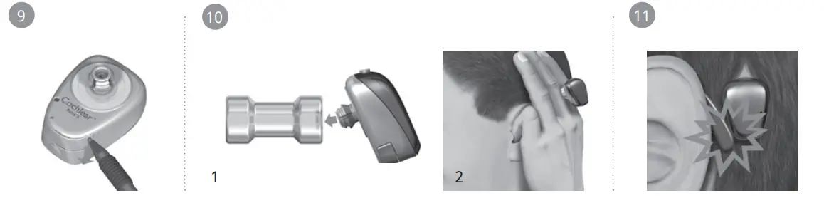 Cochlear-Baha-5-Sound-Processor-fig-5