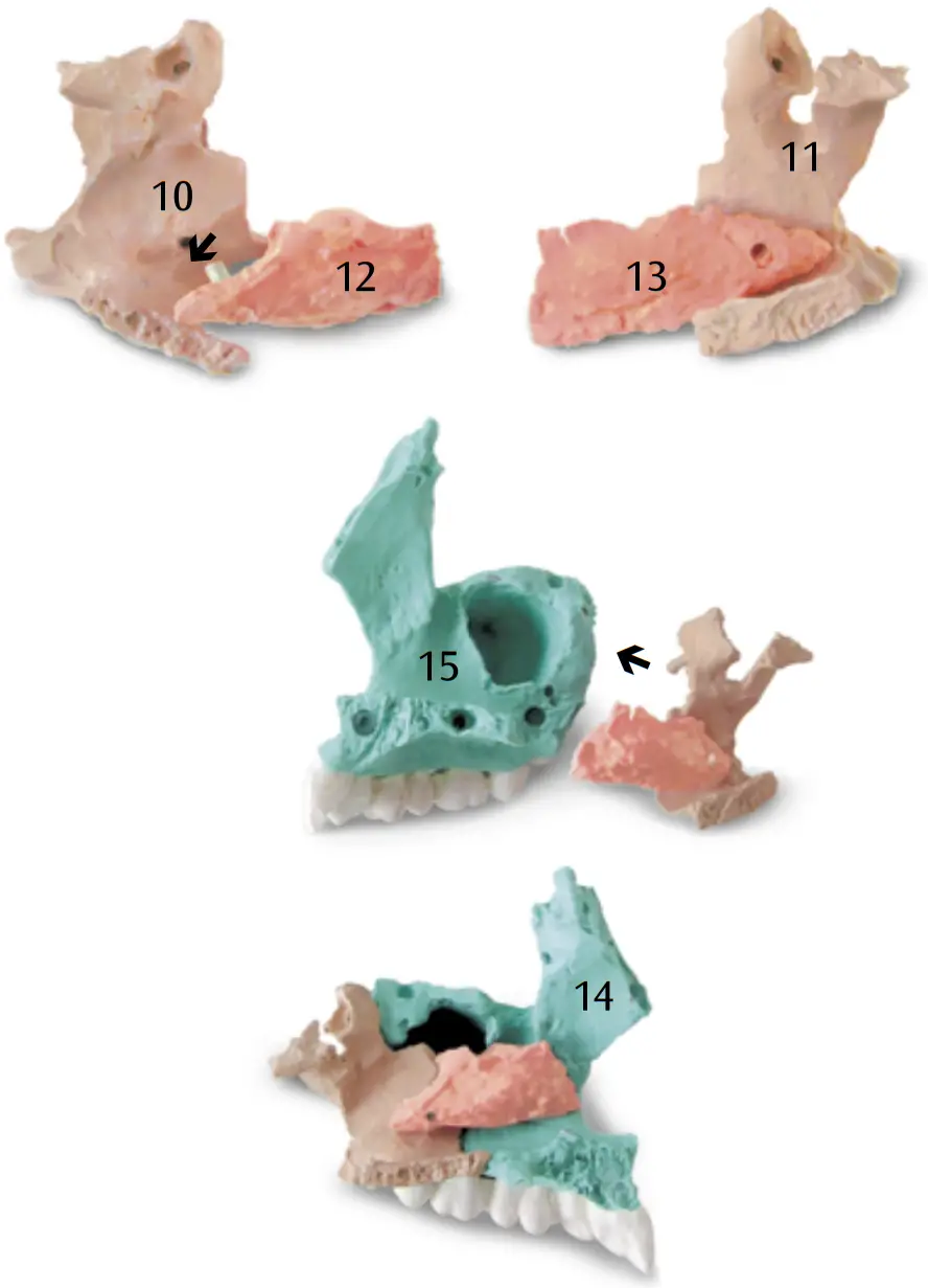 3B Scientific 12 4554 Human Skull Kit - FIGURE 7