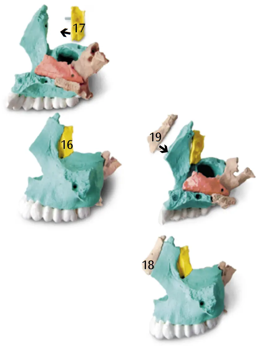 3B Scientific 12 4554 Human Skull Kit - FIGURE 8