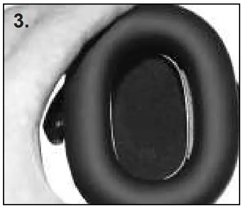 Hygiene kit replacement