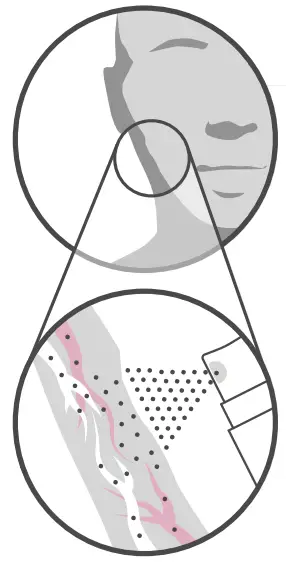How intra-oral spray
technology works