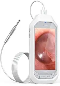 eutto Ear Otoscope with Screen