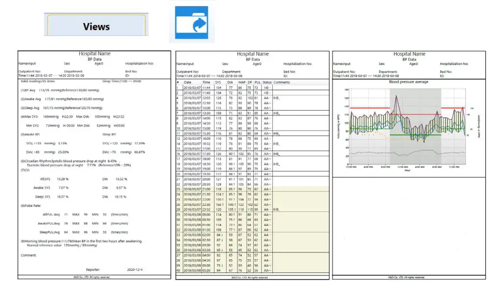 A D TM-2440 Professional Ambulatory Blood Pressure Monitor User Guide - Click on the Print icon to print results