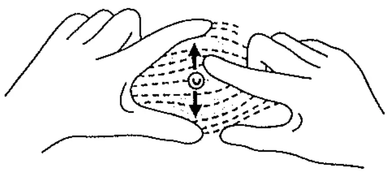 Stiefel Biopsy Punch fig 4