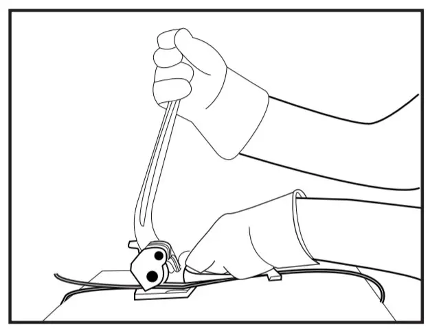 ULINE H-38 Standard Steel Tensioner - fig2