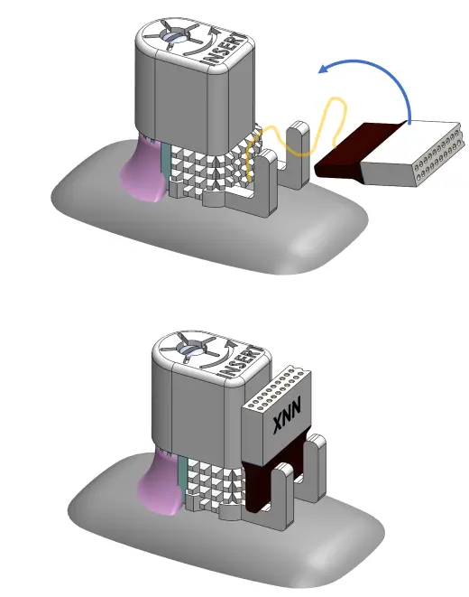 NeuroNexus-dDrive-Microdrive-Screwdriver-Kit-11