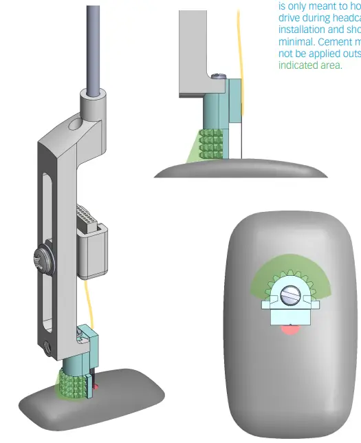 NeuroNexus-dDrive-Microdrive-Screwdriver-Kit-4