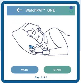 VIRTUOX-WatchPat-One-E-Home-Sleep-Testing-fig-9