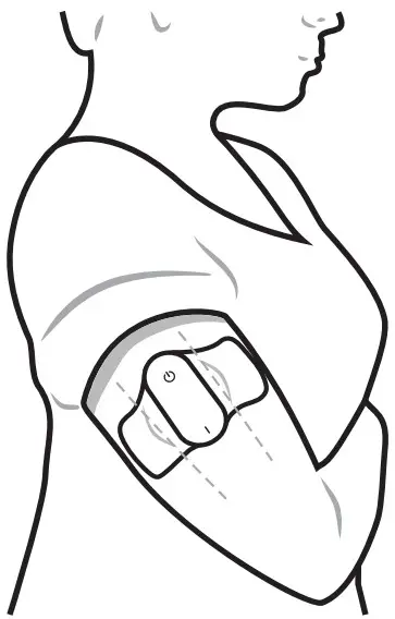 Nerivio theranica Remote Electrical Neuromodulation Device - Figure 9