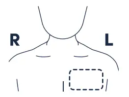 BiointelliSense V2 BioButton Temperature and Vital Signs Monitoring Device-Fig2