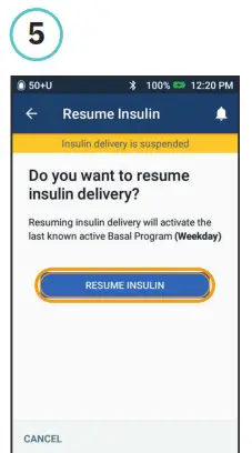omnipod DASH Insulin Management System - Suspend and Resume Insulin Delivery 5