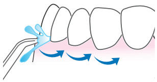 waterpik FN 20029793-F AA waterflosser -2