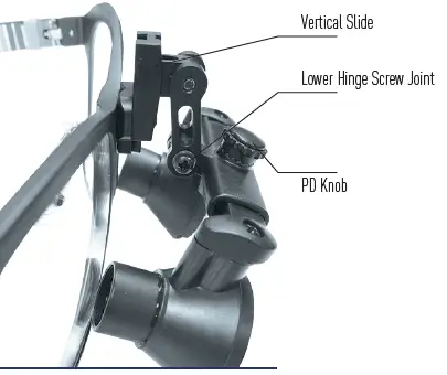 Orascoptic-Dental-Loupes-Headlights-solution-fig-4