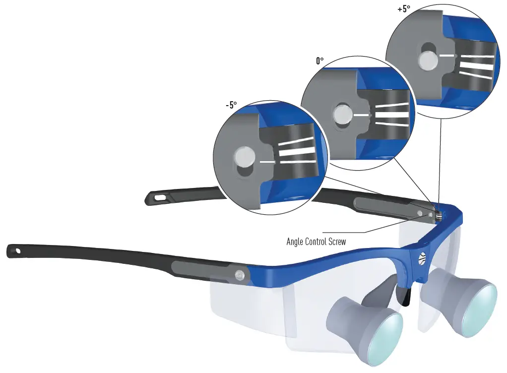 Orascoptic-Dental-Loupes-Headlights-solution-fig-5