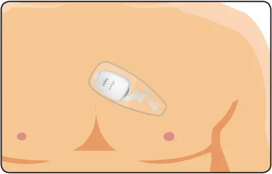 ePatch PBT - Important Information