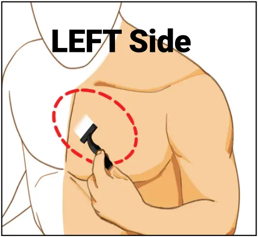ePatch PBT - Quick Start Step 1 - 1