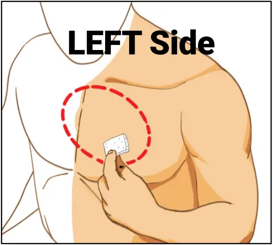 ePatch PBT - Quick Start Step 1 - 2