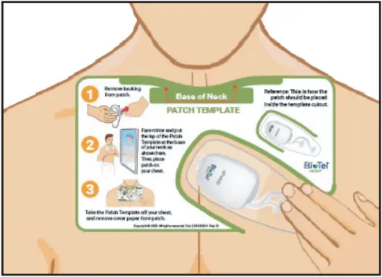 ePatch PBT - Quick Start Step 2 - 3