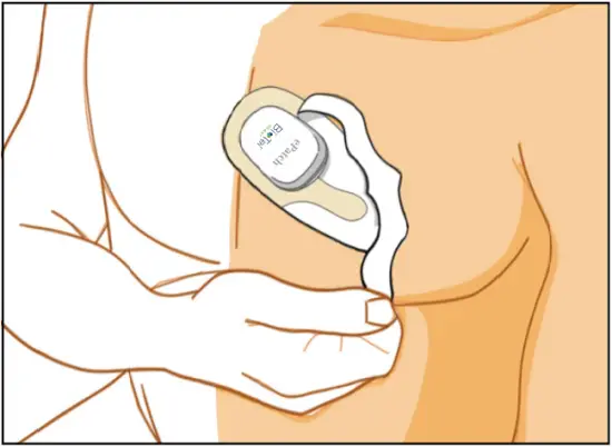 ePatch PBT - Quick Start Step 2 - 4