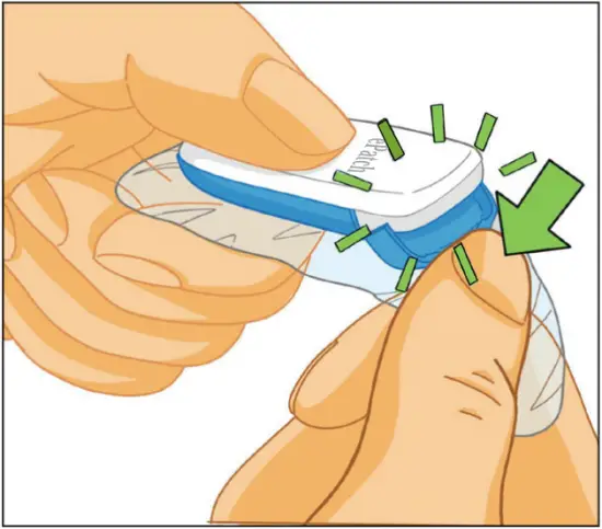 ePatch PBT - Removing the Patch 2