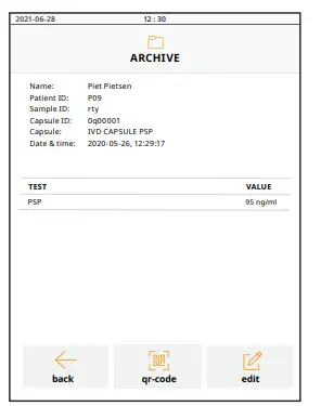 abionic-abioSCOPE-Stone-Protein-FIG15