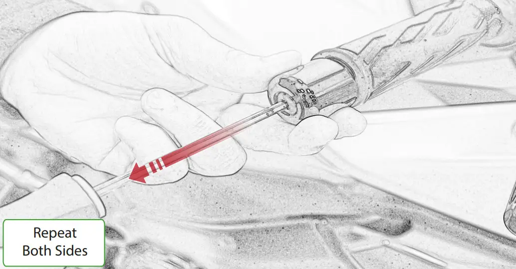 EVOTECH Suzuki GSX-S1000 Katana Clutch Lever Guard - Figure 1