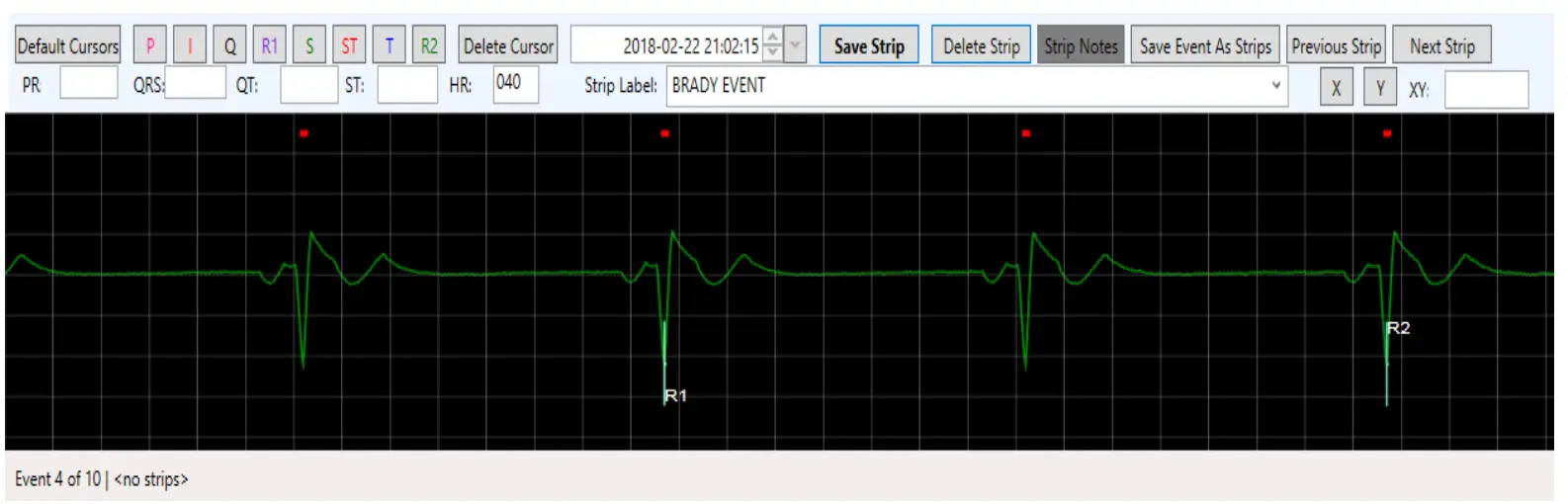 NorthEast Monitoring LX Event Recorders - Saving Strips 1