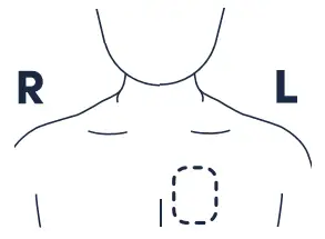 BBN-R-V2-BioButton-Temperature-and-Vital-Signs-Monitoring-Device-FIG-5