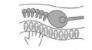 Compass-Health-MER-4500-Meridian-Ultra-Care-Excel-System-08