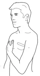 VERIDIAN HEALTHCARE 08-363 2-Second Digital Thermometer-AXILLARY