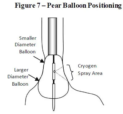 PENTAX-MEDICAL-C2-CryoBalloon-Ablation-System-fig12