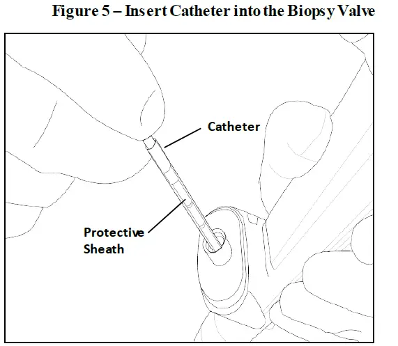 PENTAX-MEDICAL-C2-CryoBalloon-Ablation-System-fig6