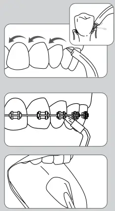 waterpik-WP-150-Series-Water-Flosser-fig-6
