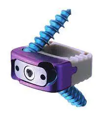 ORTHOFIX Lonestar Cervical Stand Alone Ststem