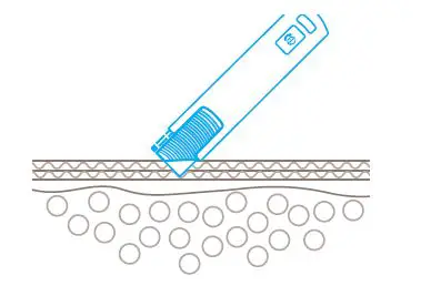 martor-Secunorm-185-Robust-Safety-Knife-fig-7