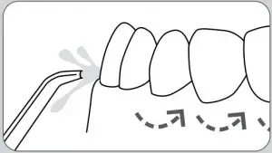 Using the Water Flosser