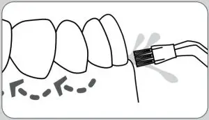 Plaque Seeker™ Tip To use the Plaque Seeker™ tip, place the tip close to the teeth so that the bristles are gently touching the teeth. Gently glide tip along gumline, pausing briefy between teeth to gently brush and allow the water to fow between the teeth.