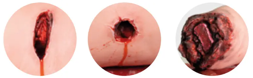 3B HEMORRHAGE CONTROL LEG TRAINER P103, P103D -FIGURE 2